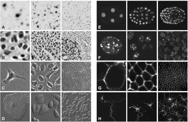Figura 1.1: Diversidade das imagens celulares.  As imagens de células podem variar bastante no que  diz  respeito  à  técnica  de  microscopia  e  coloração  aplicadas  bem  como  o  tipo de  células  analisadas  e  a  respetiva densidade celular