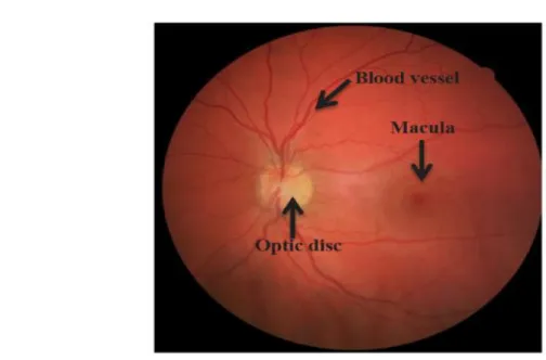 Figure 2.8: Eye Fundus image where Blood Vessels, Macula and the Optic Disk can be seen [30].