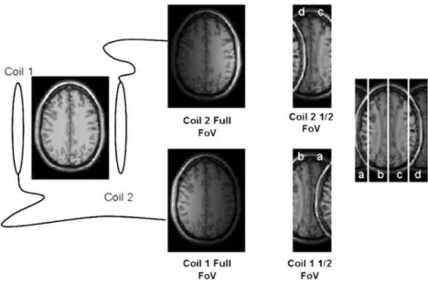 Figura 1.3-4 Esquema de reconstrução das imagem utilizando aquisição em paralelo[19] 