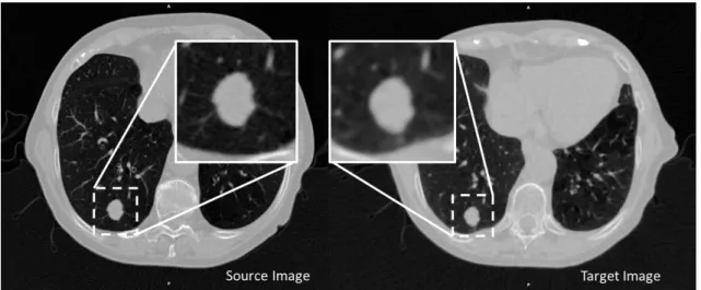 Figure 4.2: The source image, presented in axial view, will be the reference for a rigid transformation of the target image (the images do not have the same resolution)