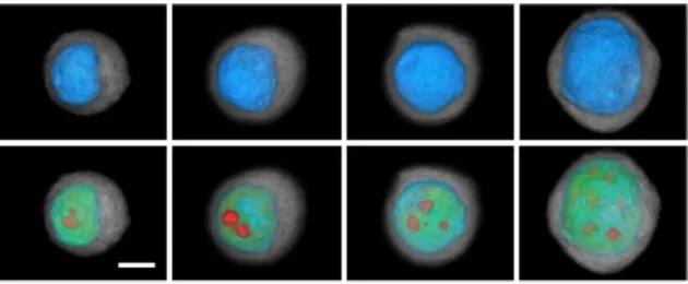 Figure 1.2 - Four cells imaged using the cell CT. On the top row the nucleus is colored in blue; on  the bottom row the nucleus presents a transparency view of the nucleus to show its insides