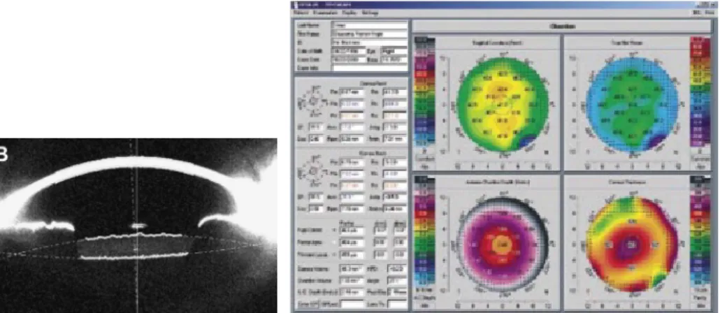 Figure 2.11: Scheimpflug-based imaging.
