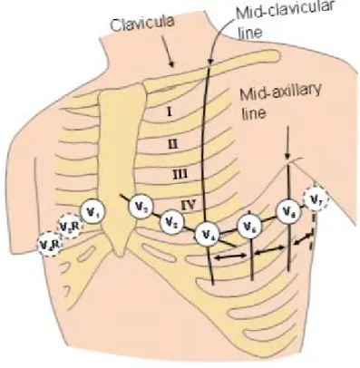 Figure 2.10 - Electrode positioning in the unipolar derivations of the thorax (V 1  to V 6 )