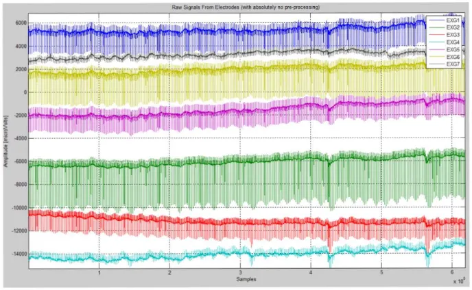 Figure 2.15 – The seven electrode channels obtained through Biosemi’s ActiveTwo acquisition system using the  Frank’s lead VCG system