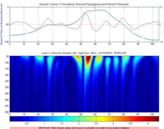 Figure 5.5 – MicroECG obtained scalogram for the P-wave using the detection wavelet: db2 