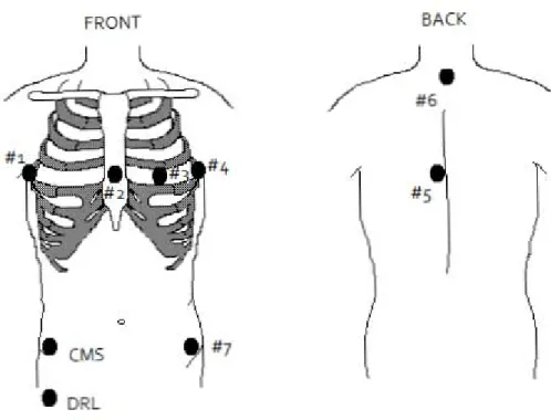 Figure 7.1 - Electrode positions used during the HR-ECG data acquisition (Frank’s leads)