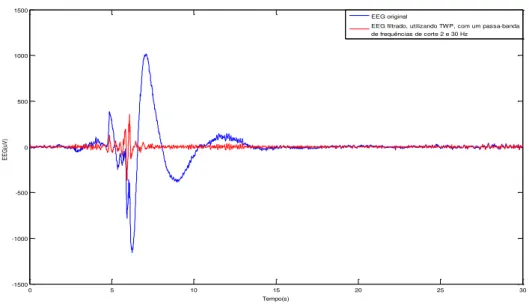 Fig. 3.7 Gráfico onde está representado o EEG de uma noite em três etapas diferentes do pré- pré-processamento