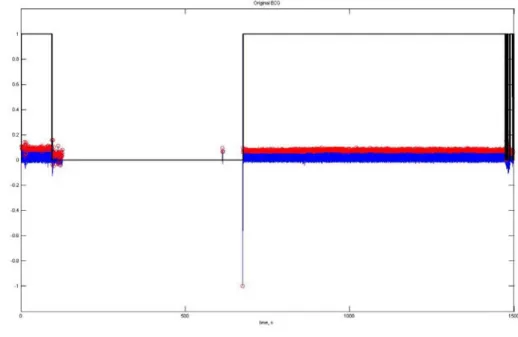 Figure 4.2.12- Elimination of the ECG noise. When the rectangular signal (black signal) is 1, it represents  a good signal; when it is 0 (zero) it represents noise