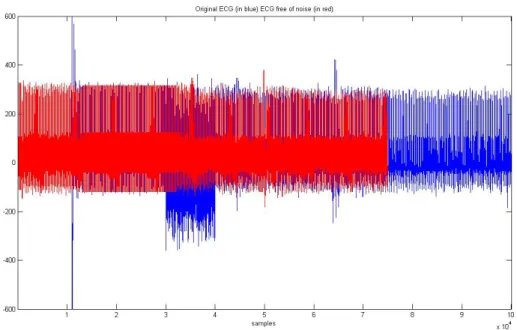 Figure 4.3.1- Marked waves onset, offset 