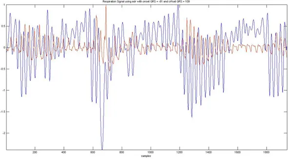 Figure 4.3.5 shows in red the Plethysmography respiration signal, and in blue the  EDR signal with linear onset/offset detection