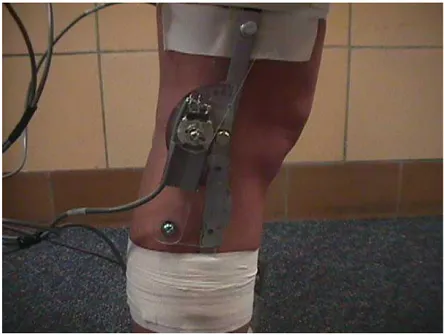 Figure 2-1- Example of a goniometer applied on a knee  Source- (Hoffman et al., 2006) 