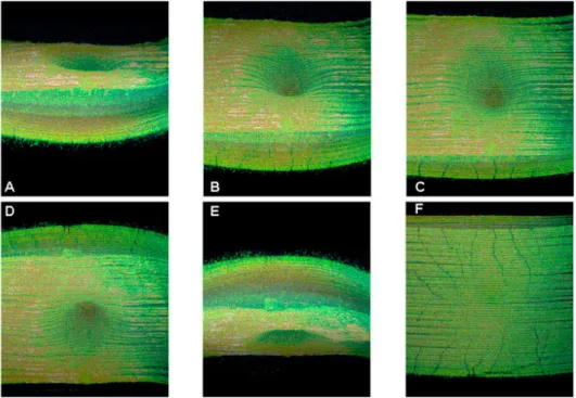 Figure 1.23 – Volumetric OCT images from a normal retina showing the fovea depression