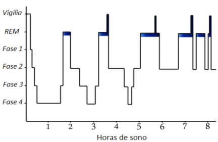 Figura 2.2 – Histograma da distribuição típica do sono de um adulto saudável [Bergantim, 2003]