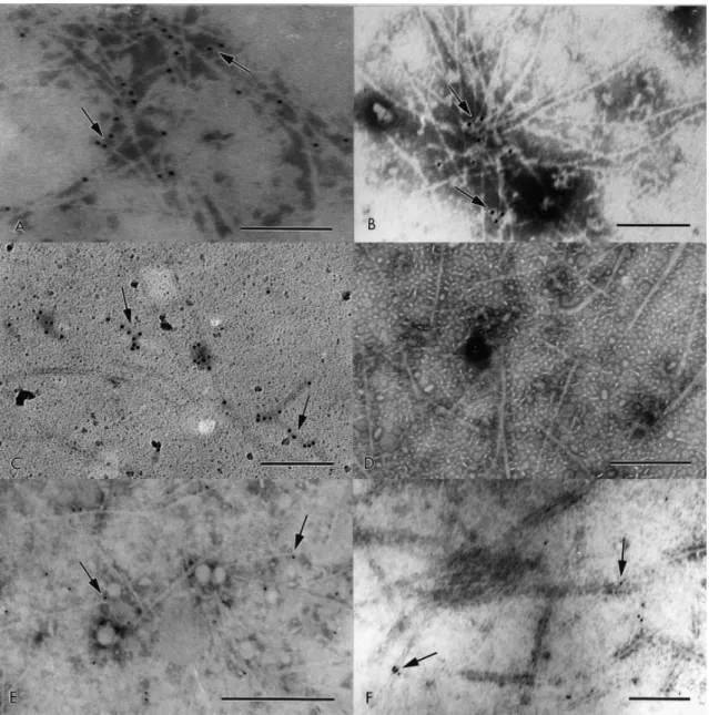 Fig. 2. Immunogold labeling assay of the enriched fimbrial preparations. CFA I (A) and CFA II fimbriae (B)  recognized  by  anti-CFA  I  and  anti-CFA  II  serum,  respectively