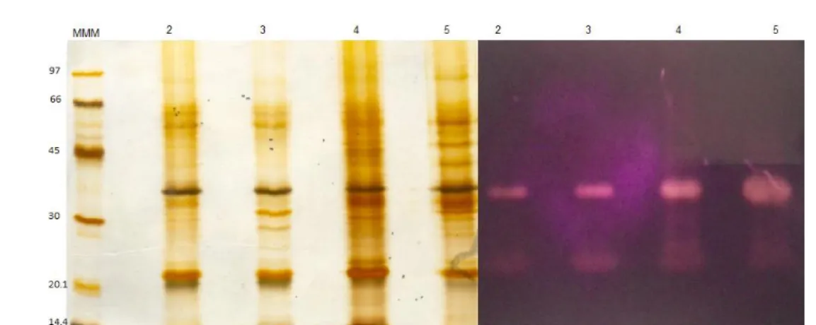 Figura  8.  À  esquerda,  perfil  proteico  do  ultrafiltrado  das  amostras  em  SDS-PAGE