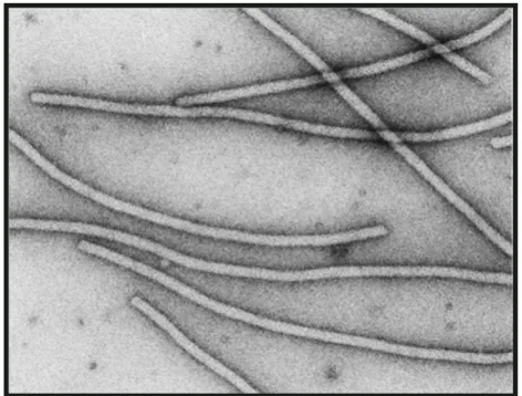 Figura 1.2: Visualização das partículas flexuosas e alongadas típicas de potyvírus por  microscopia eletrônica (Fonte: http://www.ncbi.nlm.nih.gov/ICTVdb/)