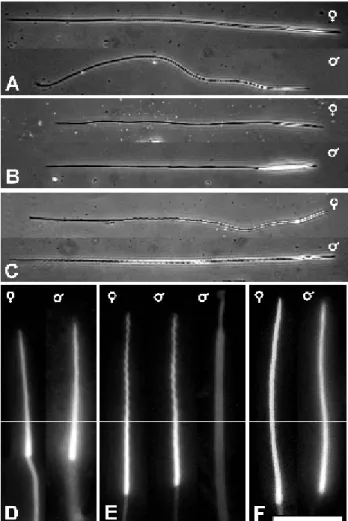 Figura 7. Micrografias de espermatozóides obtidos de espermateca ( ♀) e vesícula seminal (♂) de  vespas Idarnes
