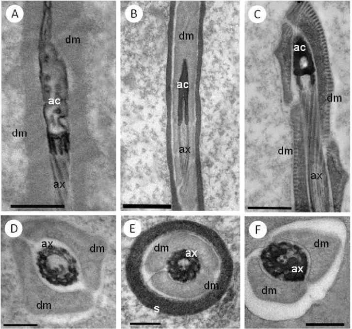 Figura 11. Micrografias Eletrônicas de Transmissão da região de transição núcleo-flagelo - inserção do  axonema