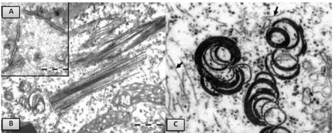 Figura  2.  Micrografia  eletrônica  de  transmissão  de  secções  finas  de  células  parenquimáticas  da  folha  de  Brugmansia  suaveolens  com  sintomas  de  mosqueado  evidenciando  as  partículas  e  os  efeitos  citológicos  causados  pelo  isolado 