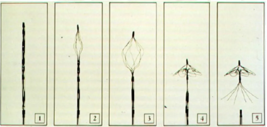 Figura 3.1: Filtro de coágulo sanguíneo [7].