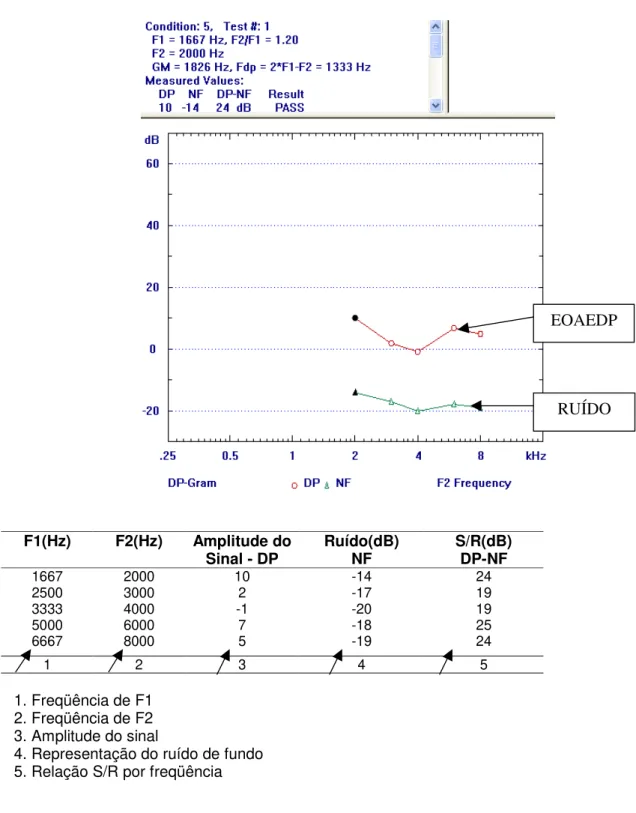 Figura 3 - Exemplo de EOAPD “passa”. 