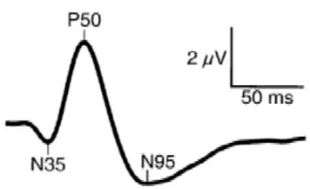 Figura 2  – Forma da onda trifásica evocada pelo PERG 