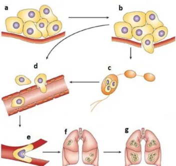 Figure 1.4: Metastatic process schematization. (a) in situ cancer. (b) invasion begins with changes in  cell-cell  and  cell-EMC  adherence,  destruction  of  stroma  and  motility