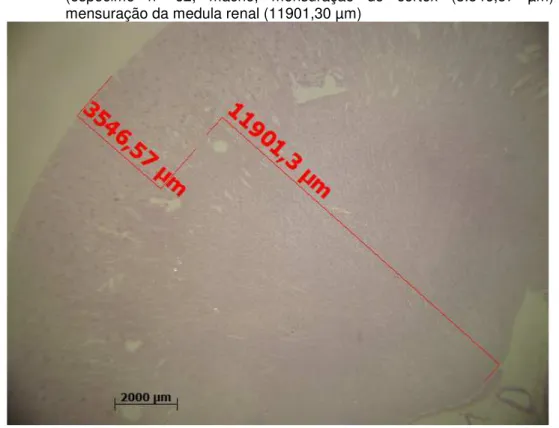 Figura  8  –  Determinação  da  altura  do  córtex  e  medula  do  rim  direito  de  indivíduo  do  grupo  3  através  de  imagem  mesoscópica  utilizando  lupa  estereoscópica  (espécime  n°  62,  macho,  mensuração  do  córtex  (3.546,57  µm)  e  mensura