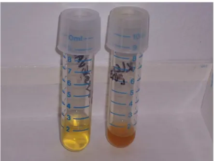 Figura 8 – Aspectos da cloração da urina de Callithrix jacchus sem  alteração nos exames (esquerda) e com alteração nos  exames (direita) 