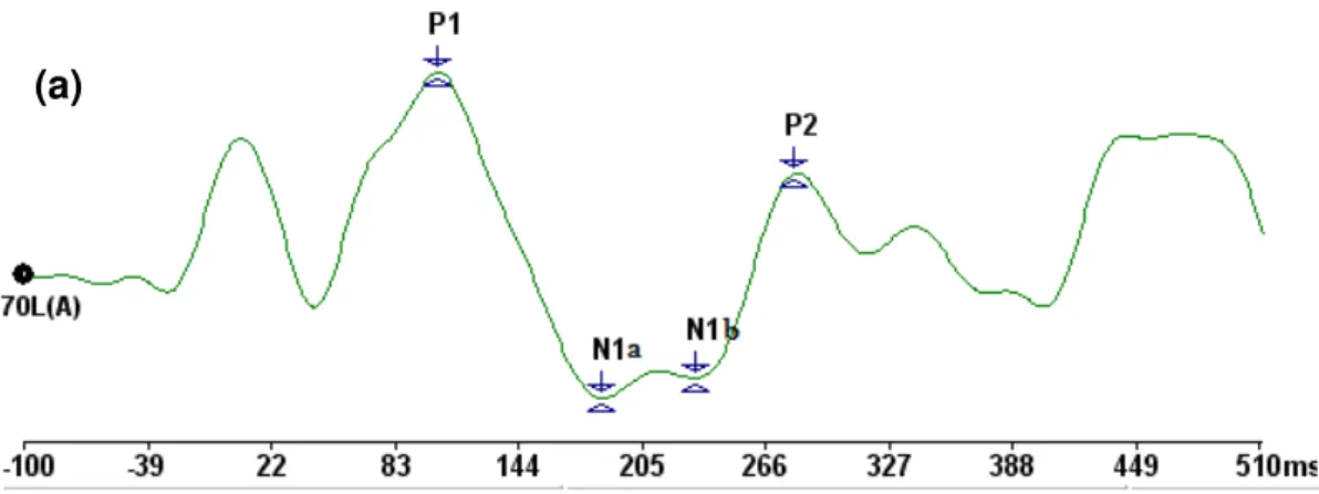 Figura 1 - Presença de duplo pico N 1  em uma criança de sete anos, com o transdutor fone  de inserção (a) e uma criança de quatro anos, com o transdutor  caixa  acústica  (b) 