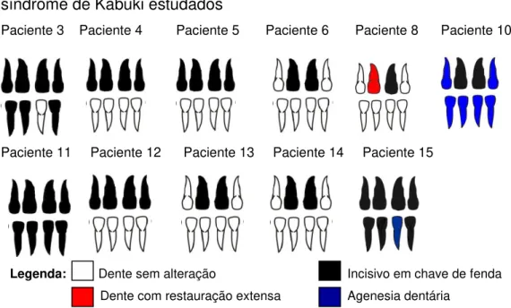 Figura  2.  Distribuição  de  incisivos  em  chave  de  fenda  nos  indivíduos  com  síndrome de Kabuki estudados 