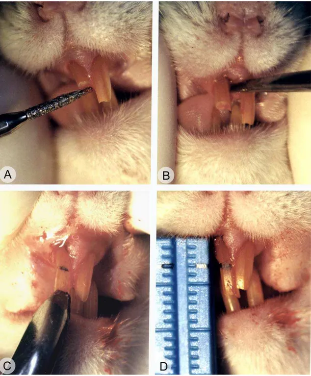 Figura 1 -  A técnica de extrusão dentária compreende: (A) desgaste da  extremidade incisal, (B) sindesmotomia, (C) extrusão com fórceps  n o  151 modificado e (D) confirmação do deslocamento de 3 mm
