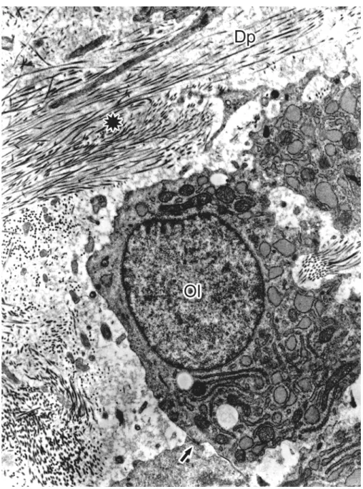 Figura 13 -  Eletromicrografia mostrando célula cúbica, com cisternas do  retículo endoplasmático dilatadas, similar ao osteoblasto,  relacionada com o aparecimento de uma matriz de dentina de  aspecto irregular com fibrilas colágenas dispostas  irregularm
