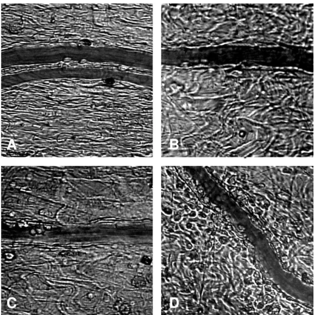 Figura  8.  Fotomicrografias  representativas  de  vênulas  pós-capilares  na  microcirculação  mesentérica,  nas  quais  (A)  INTACTO,  (B)  PEEP0,  (C)  PEEP5 e (D) PEEP10 