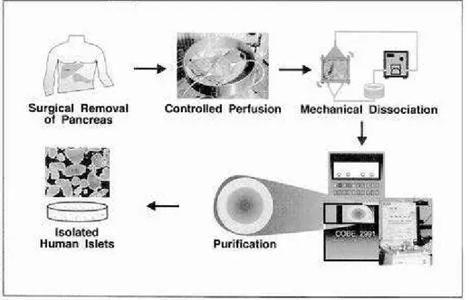 FIGURA 1 - Ilustração das etapas do processo de isolamento e  purificação de ilhotas pancreáticas humanas (Reproduzido de L AKEY  et  al., 2001) 