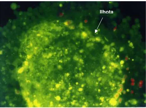 FIGURA 5 - Fotomicrografia de fluorescência (200X) de uma ilhota da  preparação de ilhotas humanas do pâncreas P28/00, corada com  laranja de acridina (em verde, células vivas) e iodeto de propídeo (em  vermelho, células mortas) 