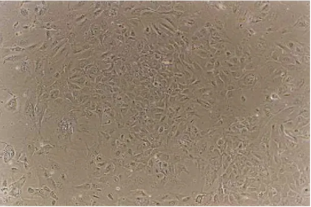 FIGURA 6 - Fotomicrografia de contraste de fase (200X) da preparação  de ilhotas humanas do pâncreas P09/99 em cultura aderente 