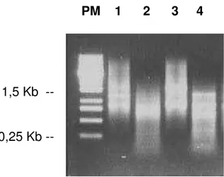 FIGURA 10 - Fracionamento dos cDNAs de Ilhotas humanas do P09/99  em gel de agarose 1,2%, antes e após digestão com RsaI  