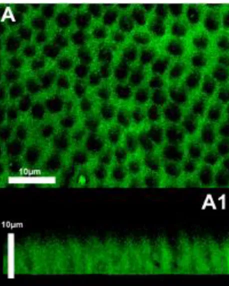 Figura 7 - Microscopia da dentina após tratamento com os ácidos OPA e MPA. A: presença de  minerais  de  cálcio  ao  longo  do  substrato  desmineralizado,  cujas  projeções  podem  ser  observadas em A1