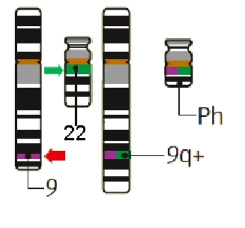 Figura 5. Translocação t(9;22). Cromossomos 9 e 22 normais, os quais na LMC são substituídos por  um  cromossomo  22  encurtado  (denominado  22q-  ou  Philadelphia)  e  um  cromossomo  9  alongado  (denominado 9q+)