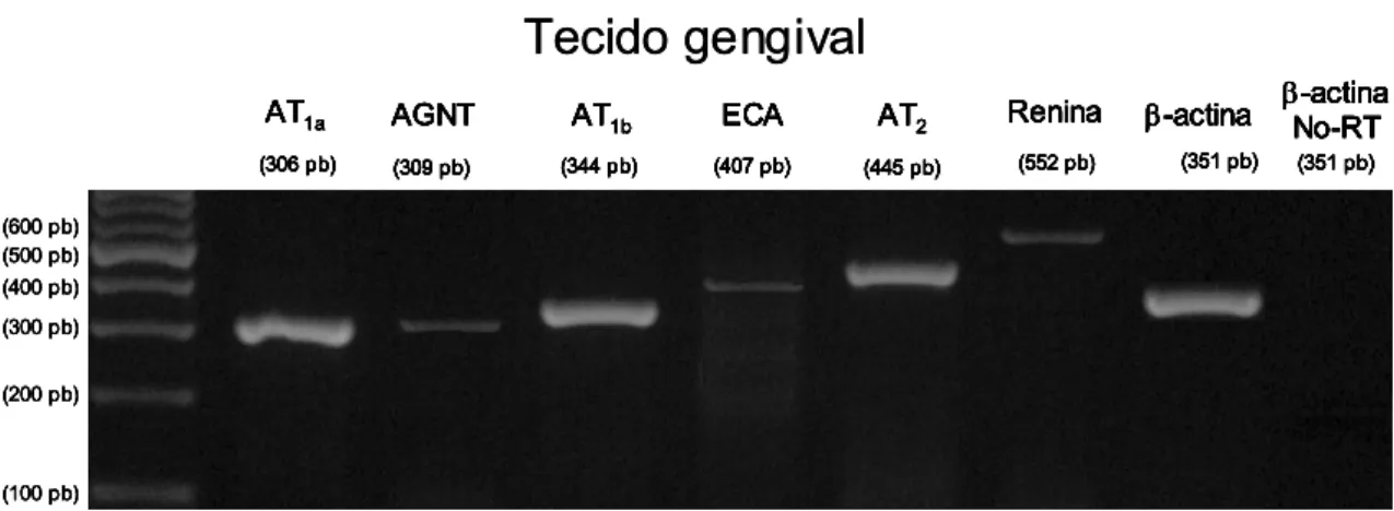 Figura 3 – Gel de agarose corado com brometo de etídio para detecção, por RT-PCR, da  expressão do RNAm para receptor AT1a (306 pb), angiotensinogênio (AGTN, 309  pb), receptor AT1b (344 pb), enzima conversora de angiotensina (ECA, 407 pb),  receptor AT2 (