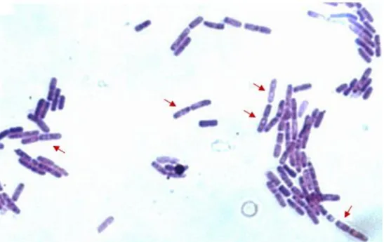 Figura  10.  Microscopia  ótica  com  aumento  de  1000x  de  uma  colônia  de  10  dias  da  bactéria  FT9  corada  para  a  visualização  de  endósporos