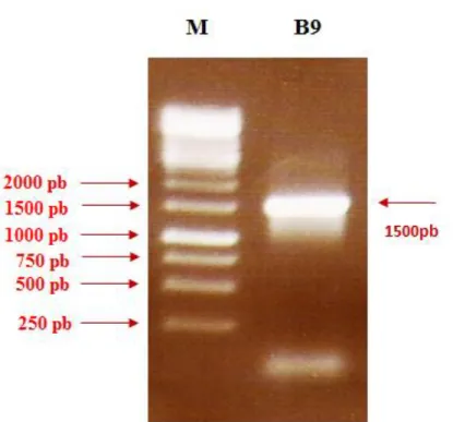 Figura  11.  Análise  eletroforética  de  produto  de  PCR  em  gel  de  agarose  0,8%