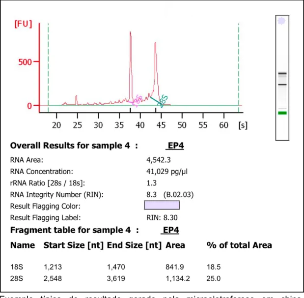 Figura 4 – Resultado de microeletroforese de RNA em chip 