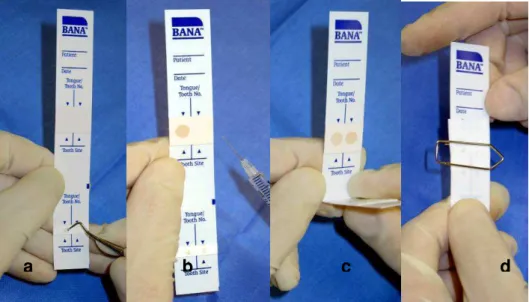 Figura  08  –  a)  colocação  da  saburra  na  fita  teste  com  colher  de  dentina;  b)  colocação de água destilada na fita teste; c) dobragem da fita; d)  fita presa com clipe de papel