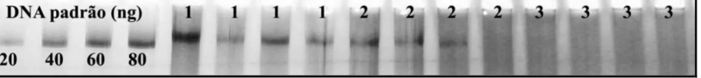 Figura  10  -  Gel  de  poliacrilamida  comparando  os  métodos  de  extração  de  DNA  de  teca