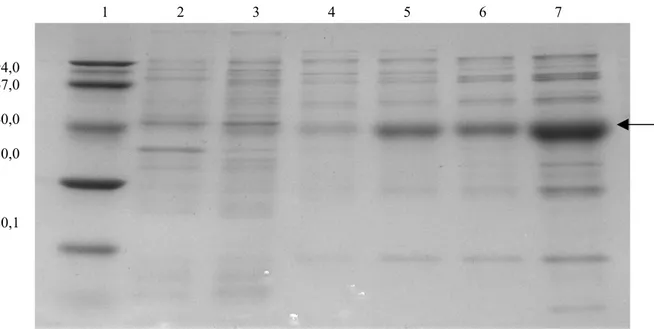 Figura 8. Tempo ideal para indução da expressão da proteína M1ABC   Faixa 1-  marcador de peso molecular; Faixas 2 a 7- extratos de bactéria BL21-DE3 transformada com o vetor  pAT-M1ABC em vários tempos; de 1 a 6 horas pós indução com IPTG, respectivamente