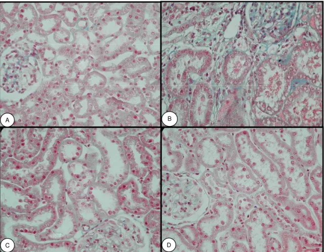 Figura 9: Fotos representativas do área intersticial relativa nos animais Sham, NX, NXSC1 e NXSC3  no 60 o  dia de pós-operatório (A) rato controle, (B) rato 5/6 sem células Lin  (C) rato 5/6 com infusão  células no 15 o  dia pós-operatório e (D) rato 5/6 