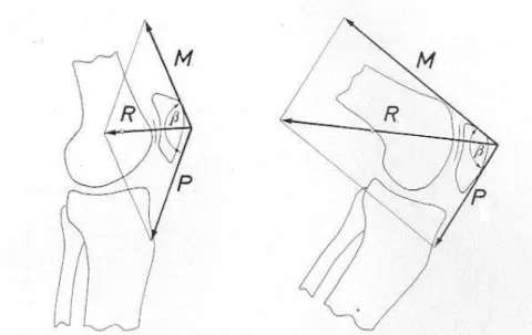 Figura 1: As forças internas da articulação patelo-femoral (M, força do tendão do músculo quadríceps; 