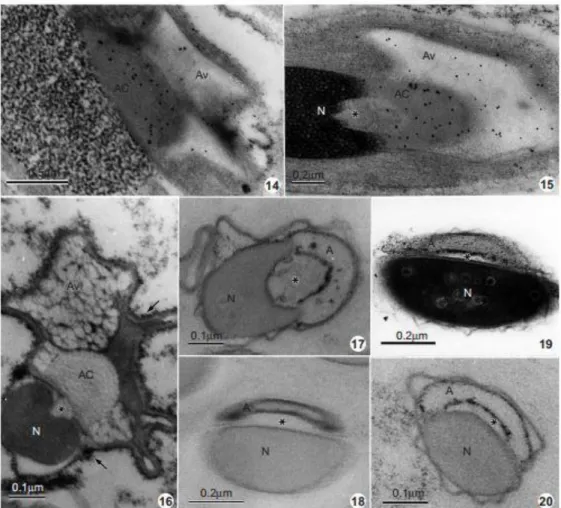 Figs  14  &amp;  15  Spermatids  in  intermediate  stage  of  development  showing  an  intense  labelling  by  Helix  pomatia agglutinin (HPA), mainly on the acrosomal content (AC) and on the acrosomal vesicle (Av)